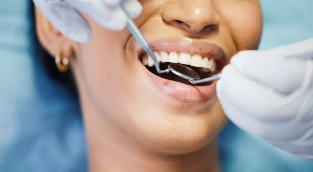 Best Broken or Chipped Tooth Repair in Buckhall, VA